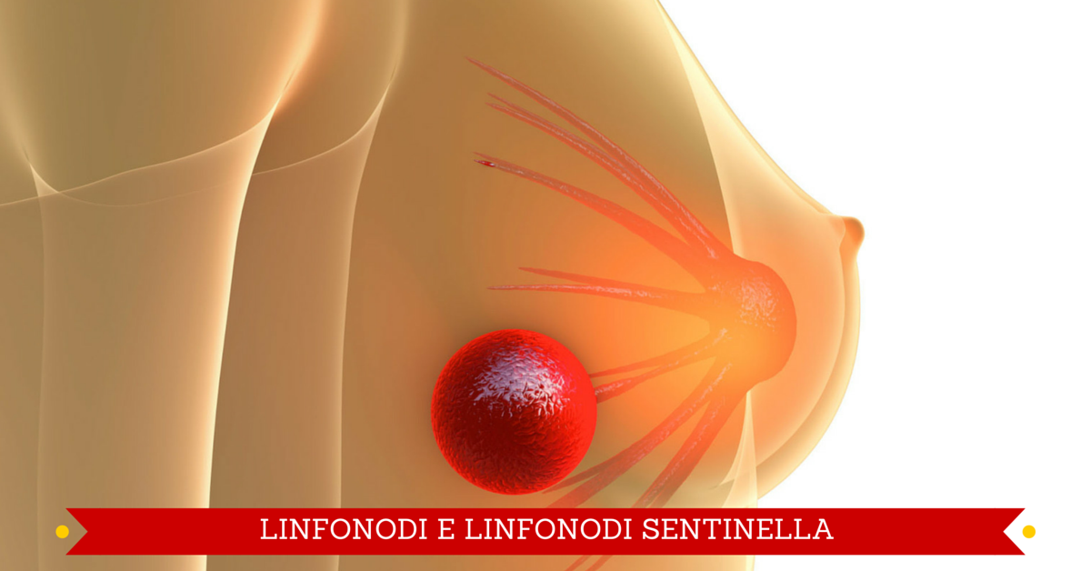 Linfonodi e linfonodi sentinella: cosa sono?