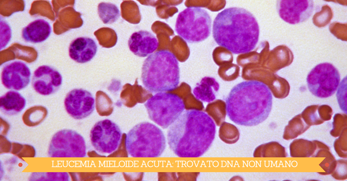 Leucemia mieloide acuta, una ricerca svela DNA non umano