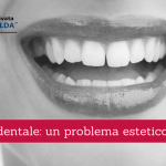 Diastema dentale, un problema estetico risolvibile 2 - Casa di Cura Villa Mafalda di Roma
