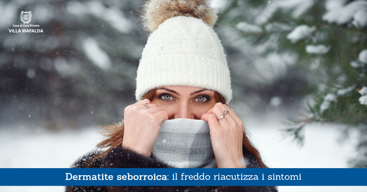 Dermatite seborroica, il freddo riacutizza i sintomi - Casa di Cura Villa Mafalda di Roma - Villa Mafalda Blog