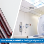 Carcinoma prostatico, la diagnosi precoce - Casa di Cura Villa Mafalda di Roma - Villa Mafalda Blog